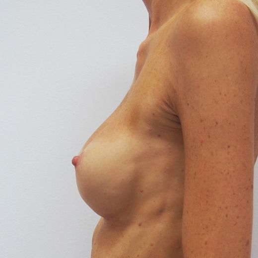 Image after