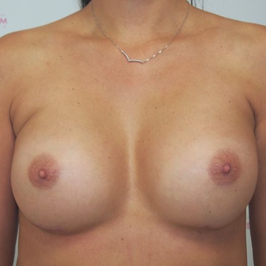 Image after