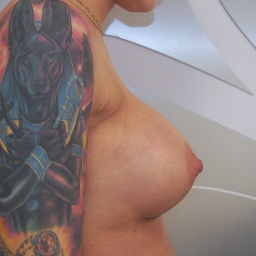 Image after