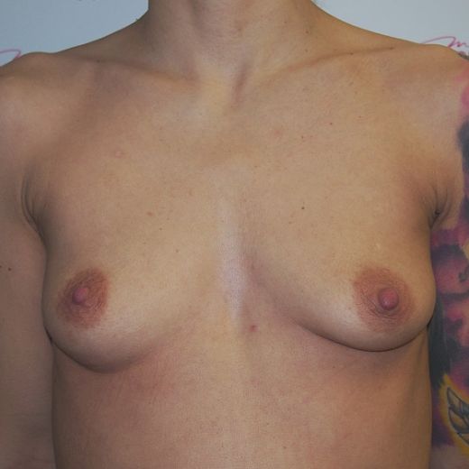 Image before