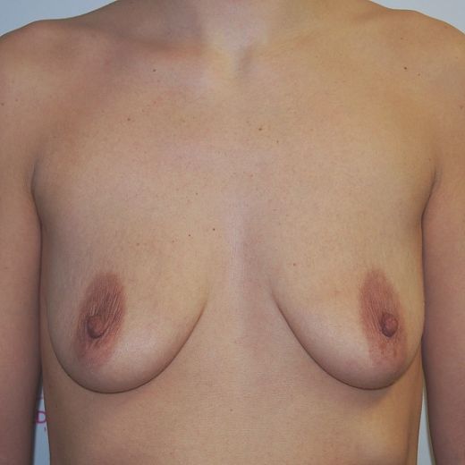Image before