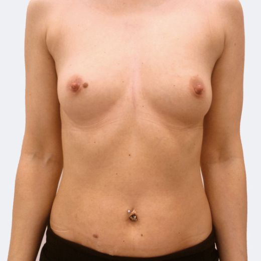 Image before