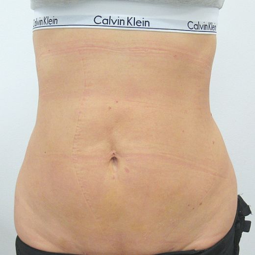 Image after