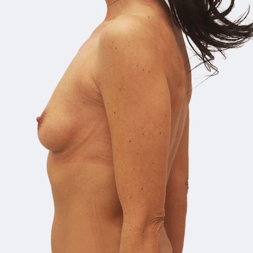 Image before