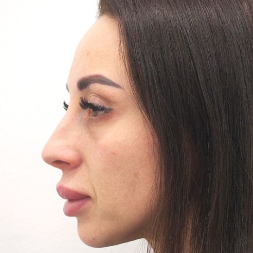 Image before