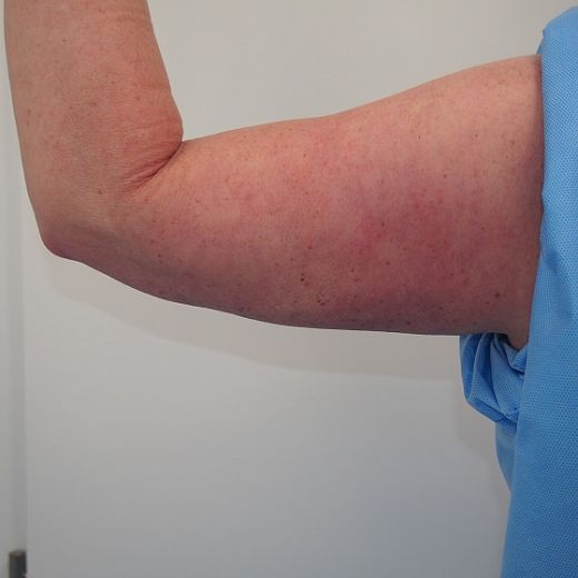 Image after