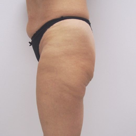 Image before