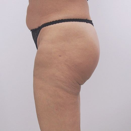Image after