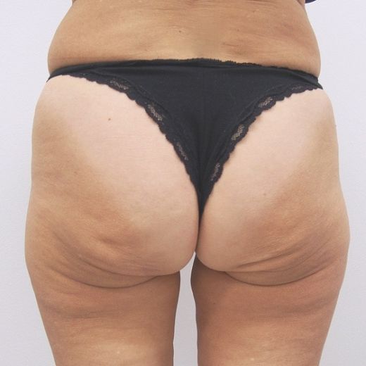 Image before