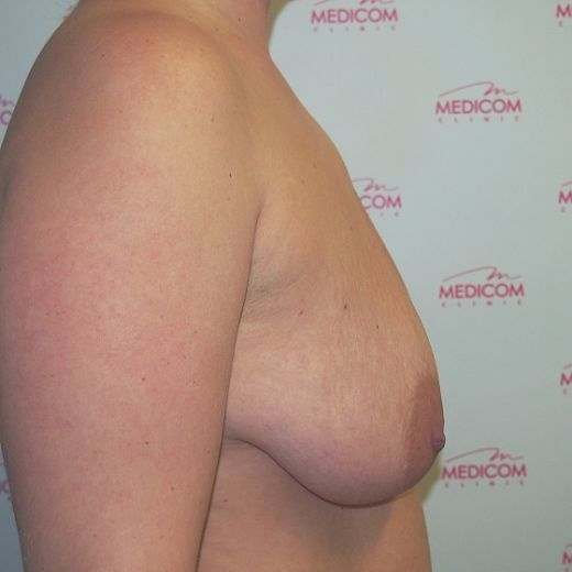 Image before