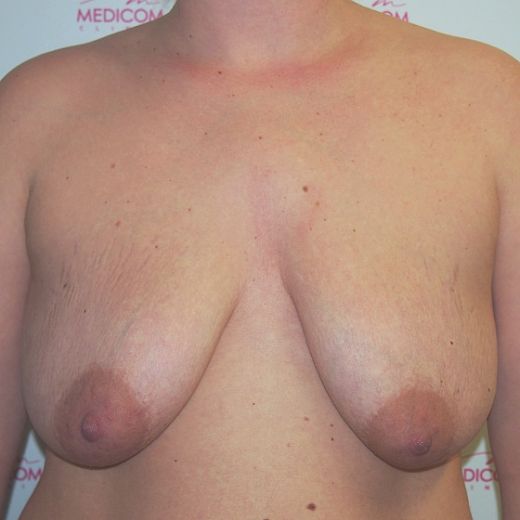 Image before