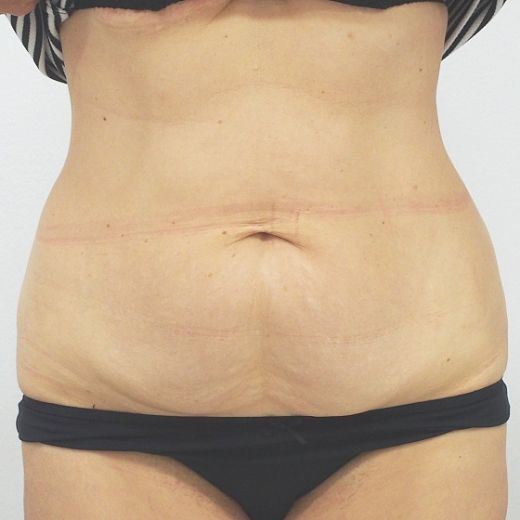 Image before