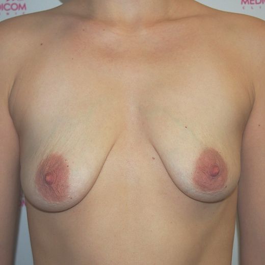 Image before