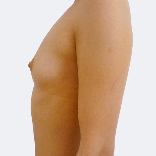 Image before