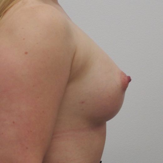 Image after