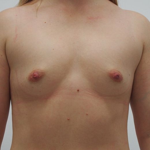 Image before
