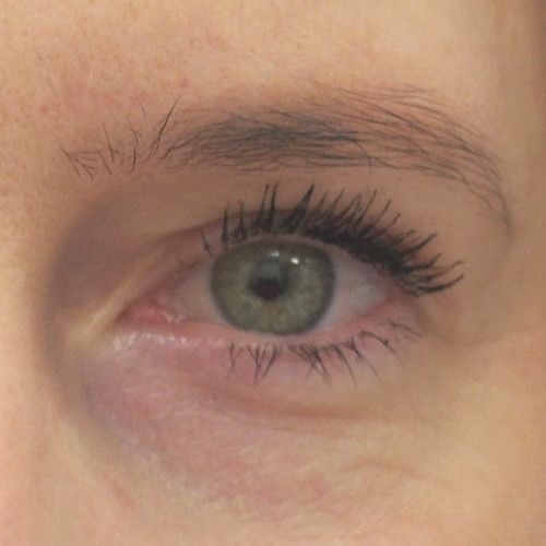 Image after