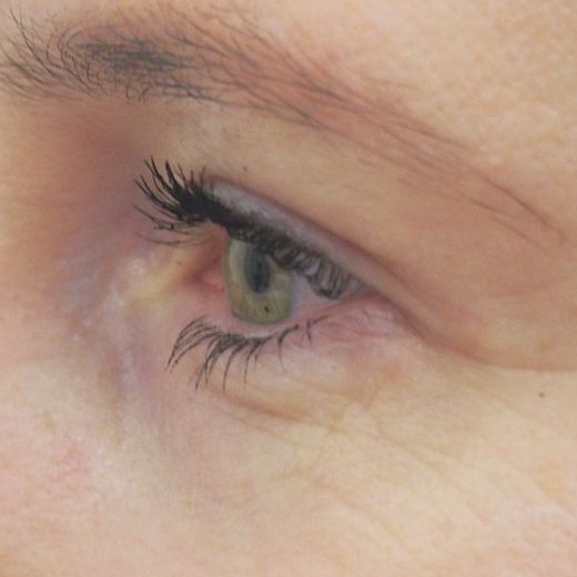 Image after