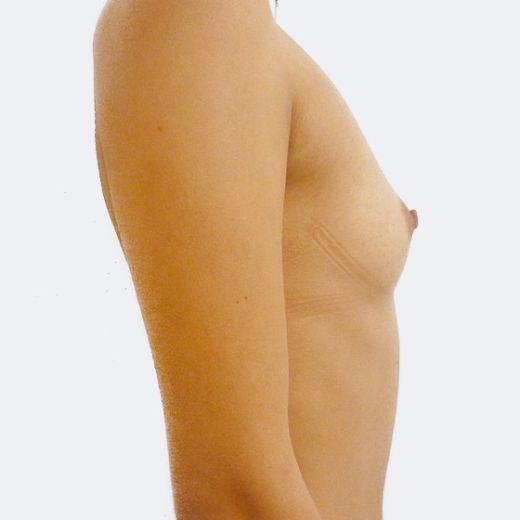 Image before