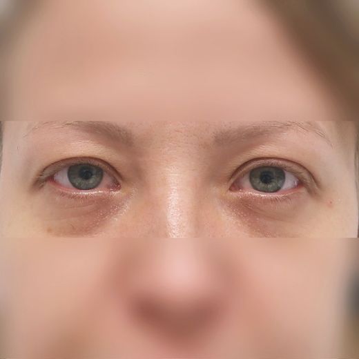 Image before