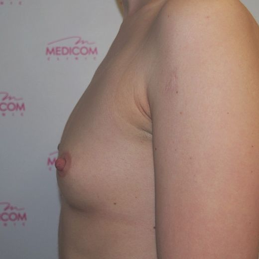 Image before