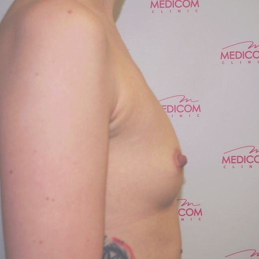 Image before