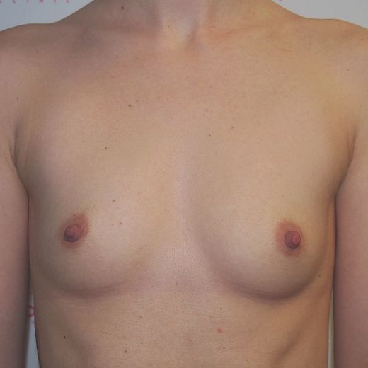 Image before