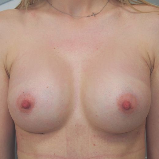 Image after