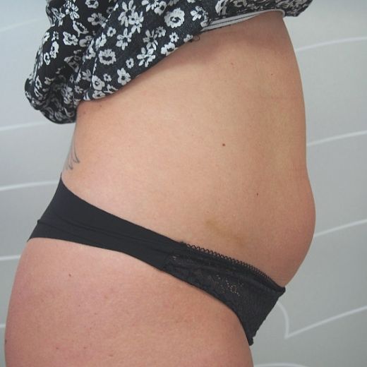 Image before