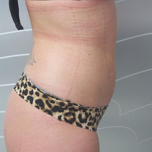 Image after