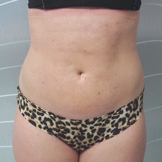 Image after