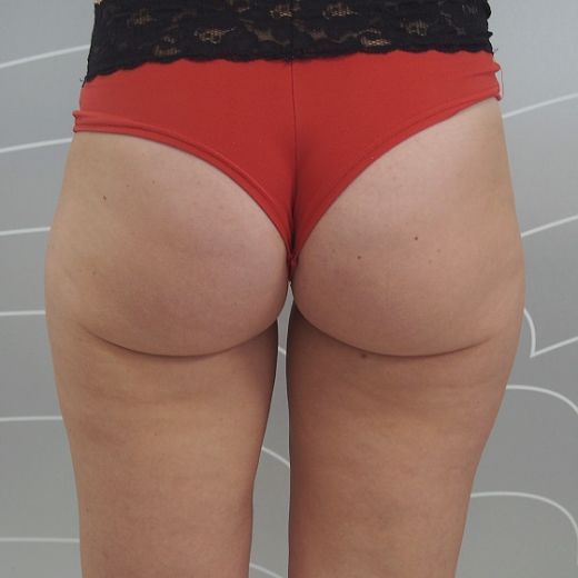 Image after