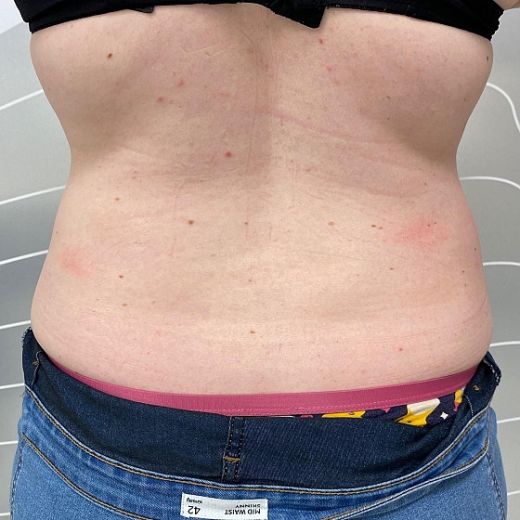 Image after