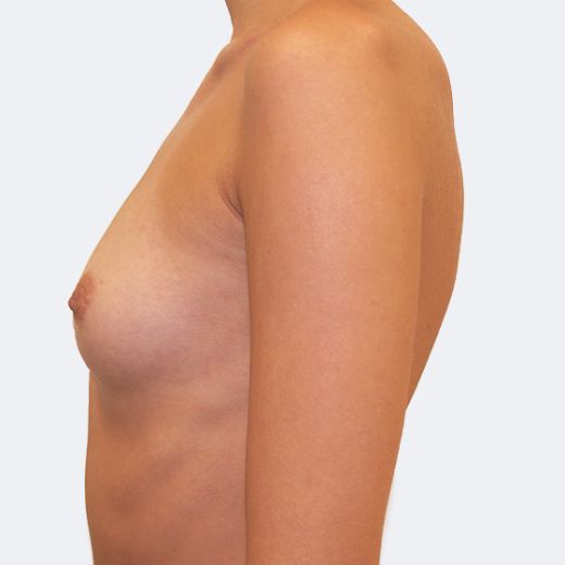 Image before
