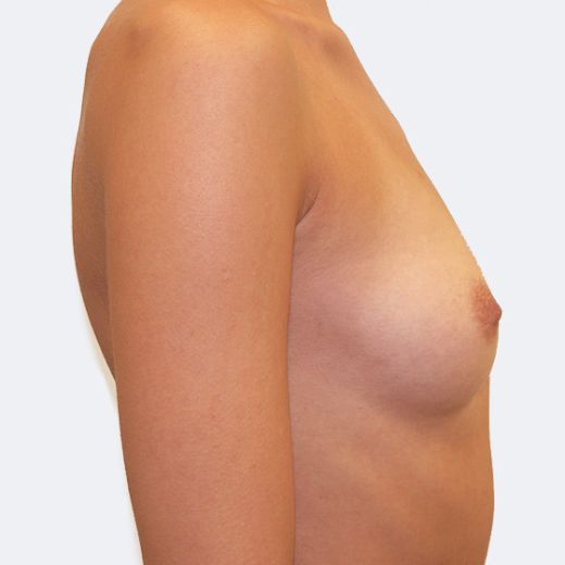 Image before
