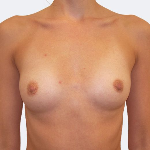 Image before