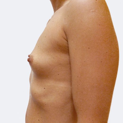 Image before