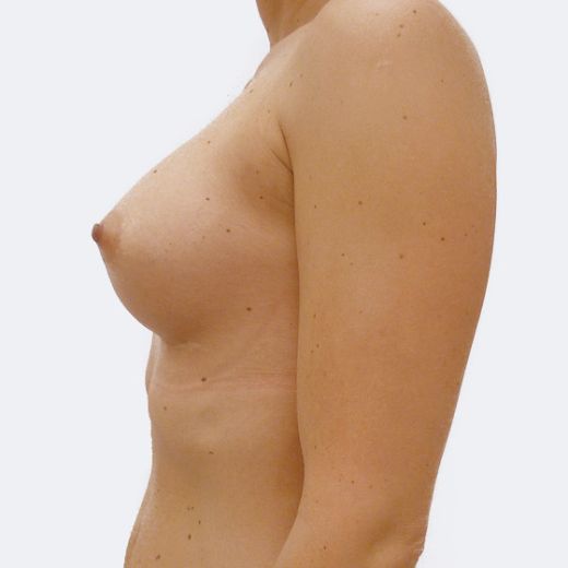 Image after