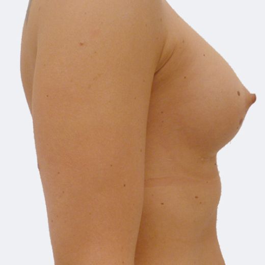 Image after