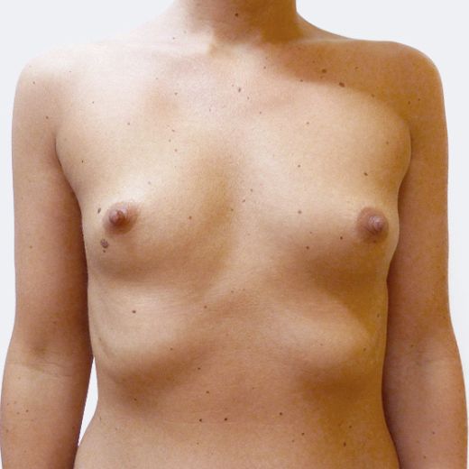 Image before
