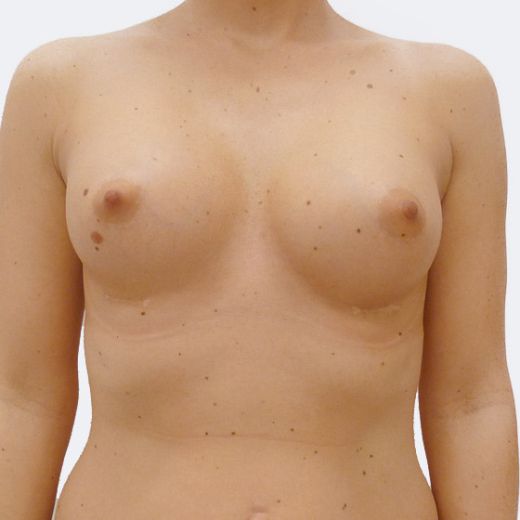 Image after