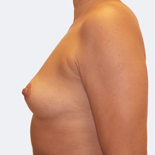 Image before