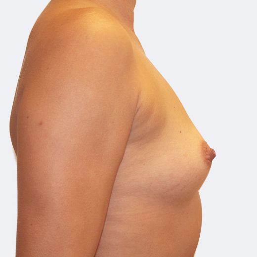 Image before
