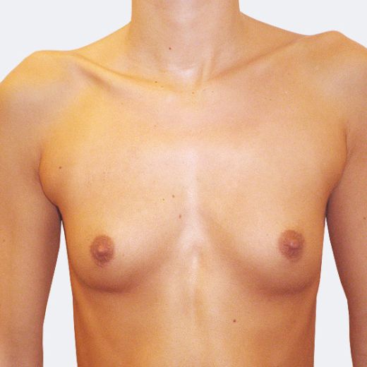 Image before