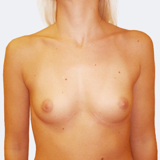 Image before