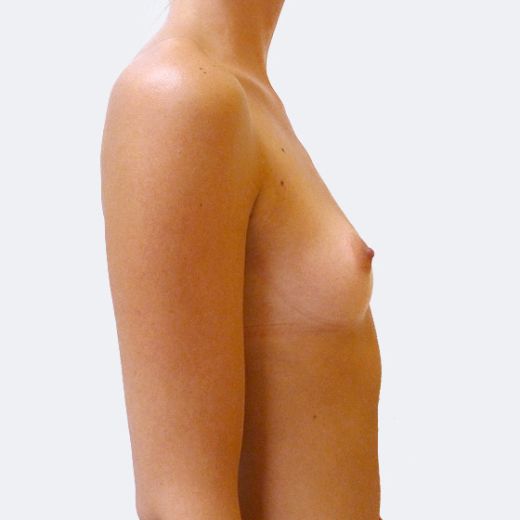 Image before