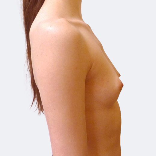 Image before