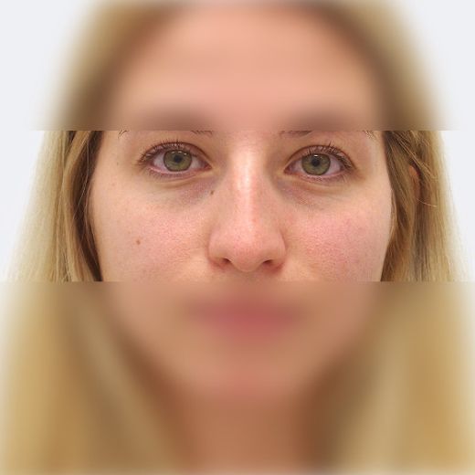 Image before