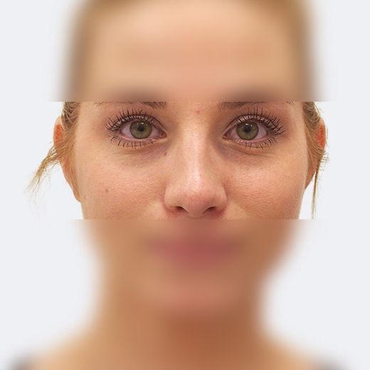 Image after