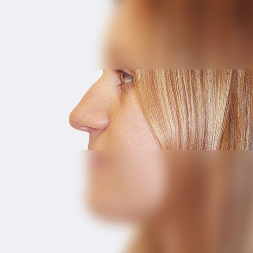 Image before